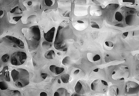 Interactive image of bone with a T-score of 0.0, which is what bone looks like without osteoporosis.