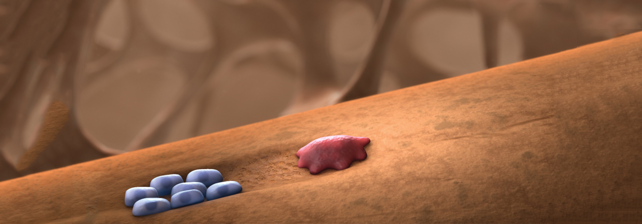 Interactive slider image showing bone-removing cells impacting your bone without treatment and with Prolia® (denosumab)